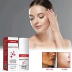 DARK SPOT CREAM  2 pc - Image 5