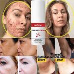 DARK SPOT CREAM  2 pc - Image 2